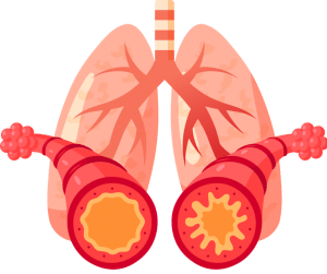 אסטמה - קורס עזרה ראשונה