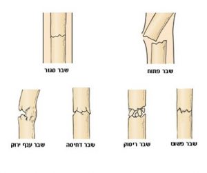 שברים - קורס עזרה ראשונה